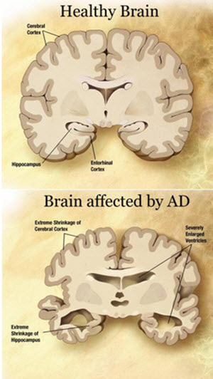 purchase ativan cheap